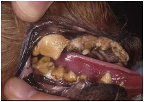 歯周病2番